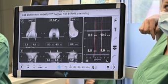 Screen computerassistierte OP