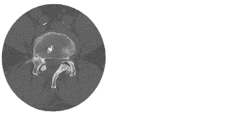 Alternatives diagnostisches Verfahren