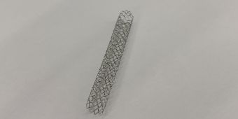 Abbildung: Ein Stent für die Herzkranzarterien