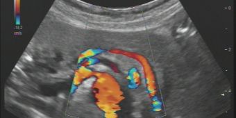 Sonographie 1